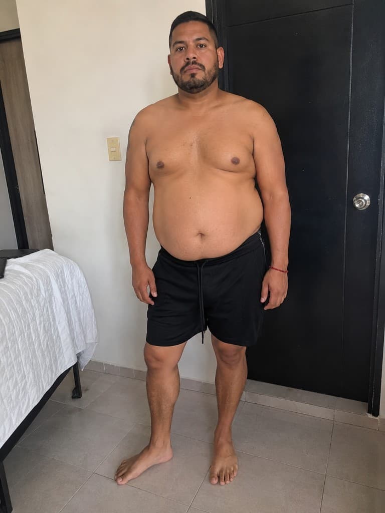 Rafael — −6 kg en 8 semanas — antes